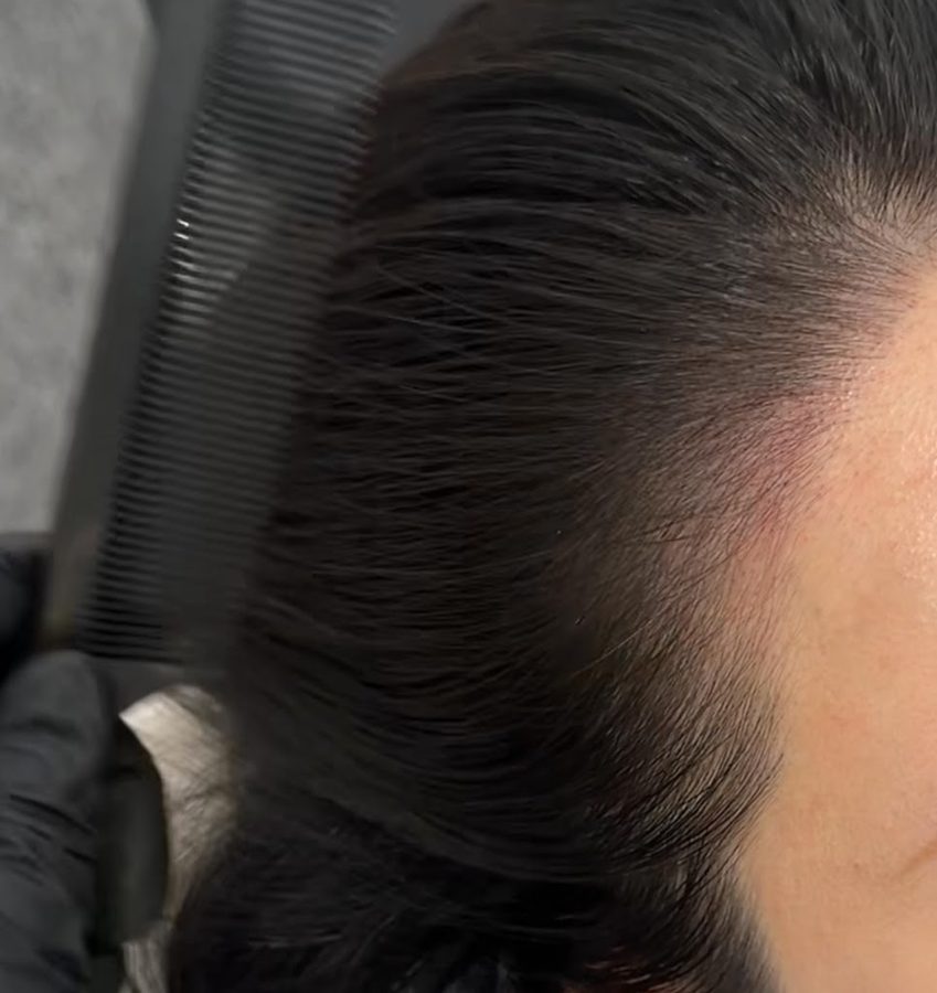 Hermin SMP Scalp Tattoo Busan Seomyeon Branch